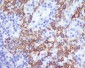 Anti-CCR2/CKR2 Rabbit Monoclonal Antibody